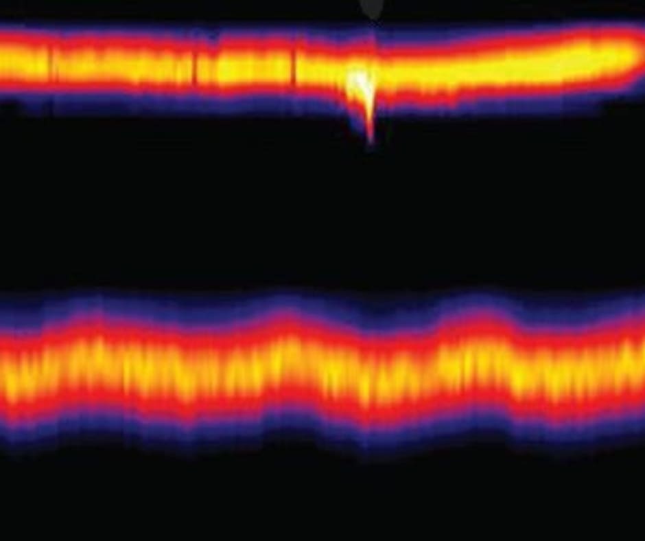 Procesos De Soldaduras Con Termografia